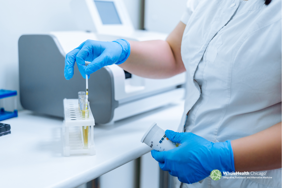 Dried Urine Test for Comprehensive Hormones