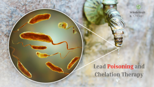 Lead Poisoning and Chelation Therapy